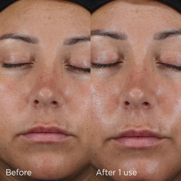 IMAGE Daily Prevention Ultra Defense Moisturizer SPF 50
