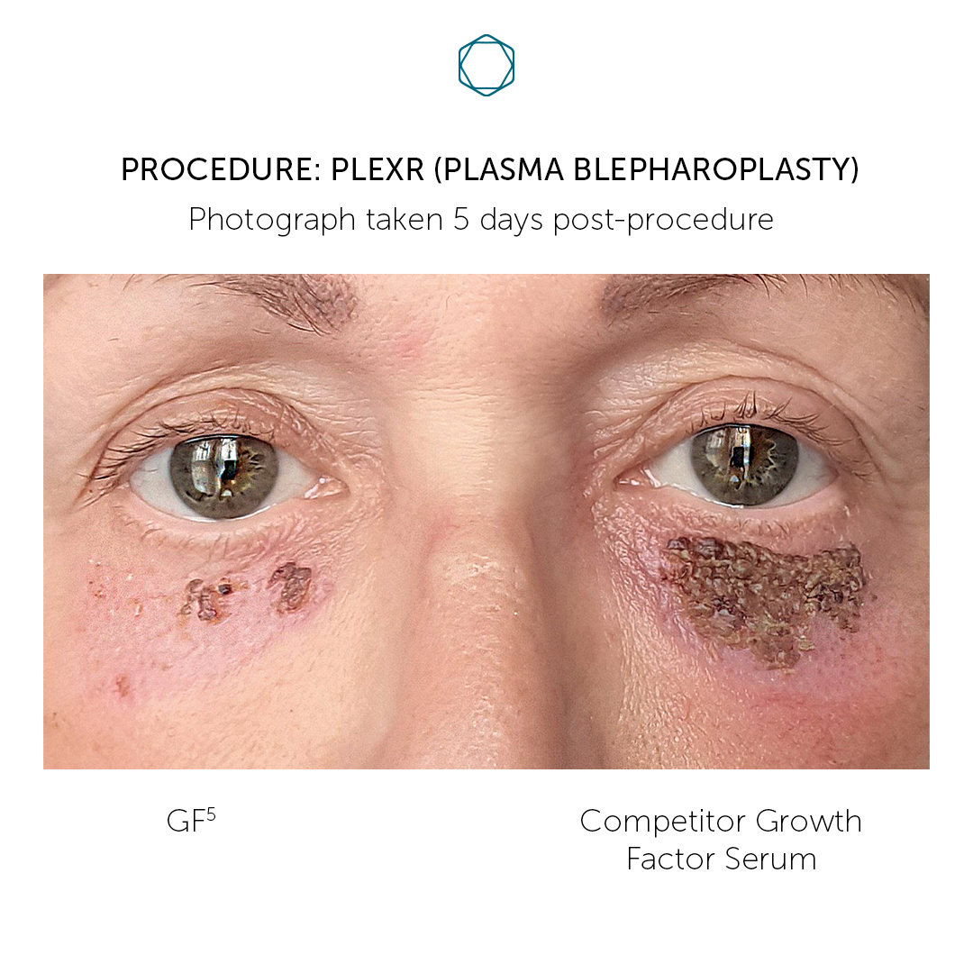 Cellderma GF5 30ml