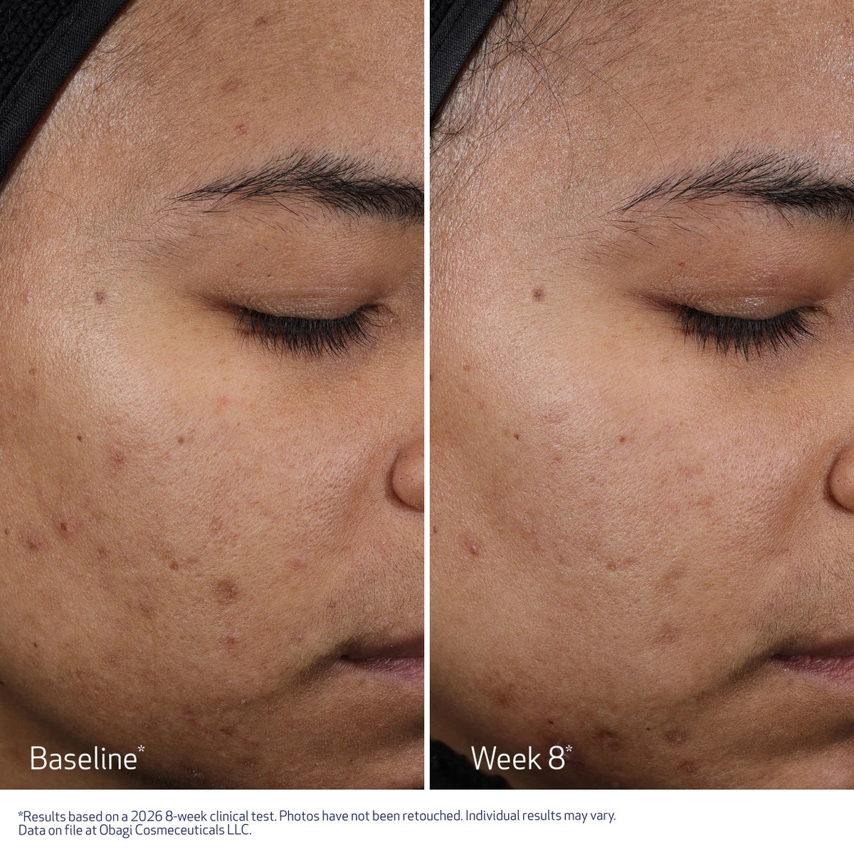 Obagi Medical CLENZIDERM M.D.® Resurfacing Multi-Acid Peel Pads (30 Pads)
