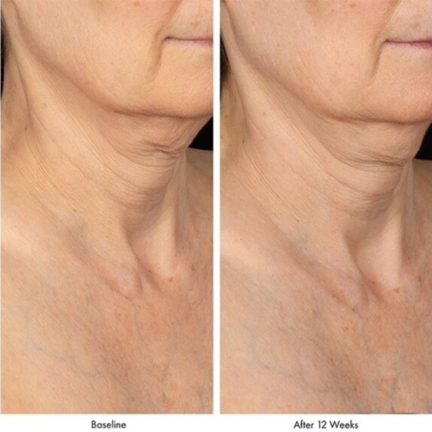 Obagi ELASTIderm Neck and Decollete Concentrate 60ml