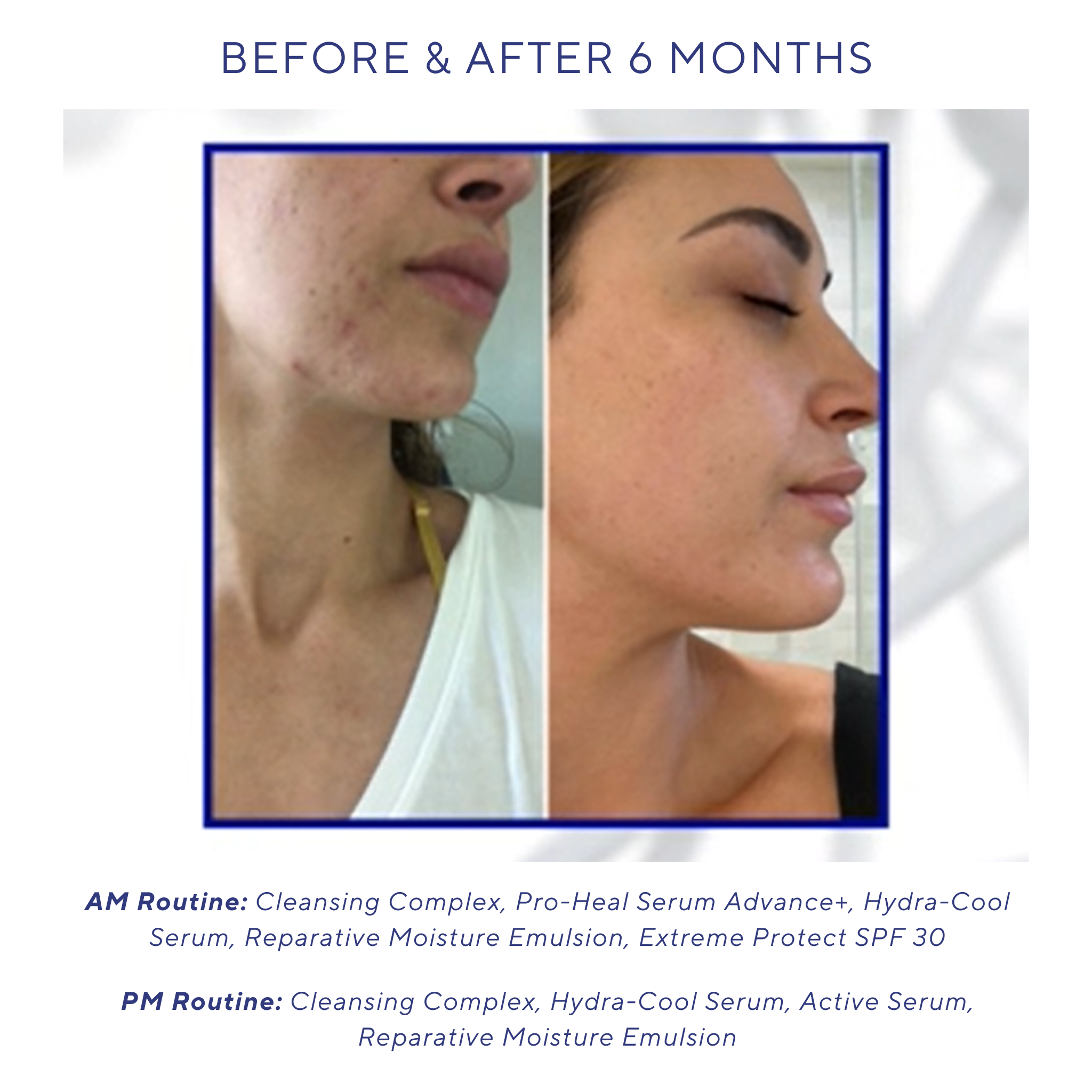 iS Clinical Active Serum