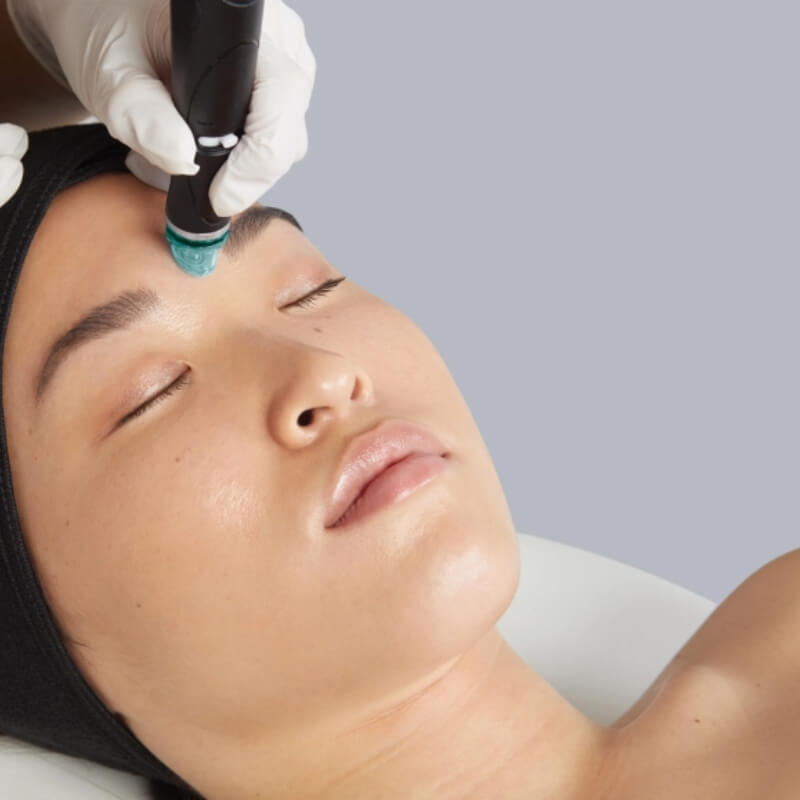 HydraFacial course of two (save up to €201)