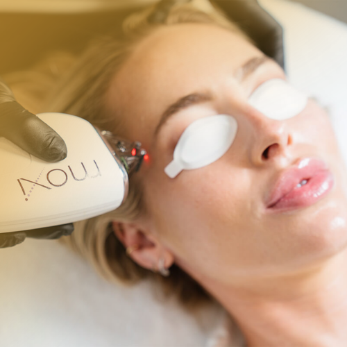 Summer Stax Laser Duo: BBL + MOXI Skin Rejuvenation (save up to €551)
