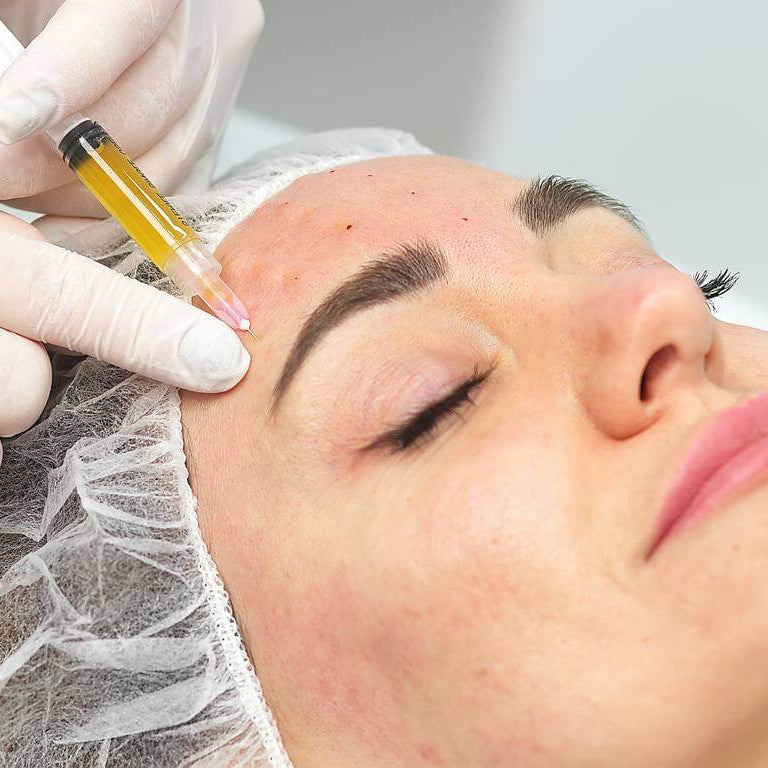 PRP (Platelet-Rich Plasma) for Face or Scalp (save up to €301)