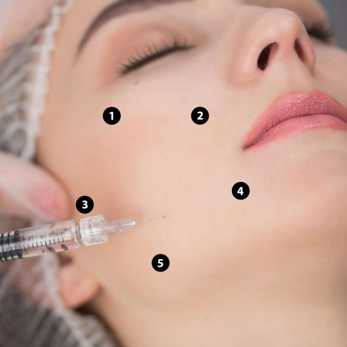 Profhilo for Face or Neck (save €101)