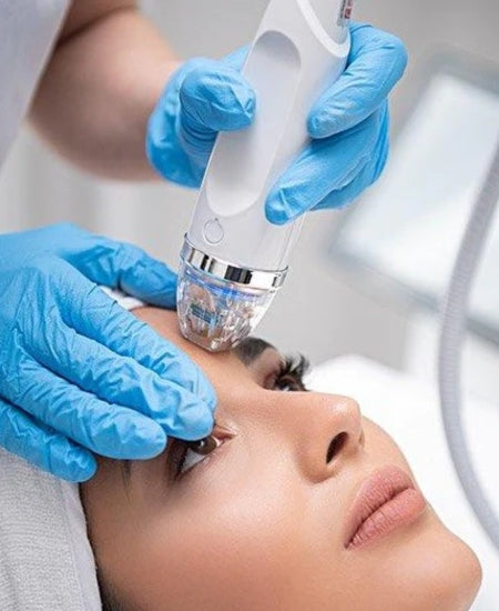 rf microneedling.jpg__PID:69806cf0-8d61-479c-8a36-ecfd6bbe2673