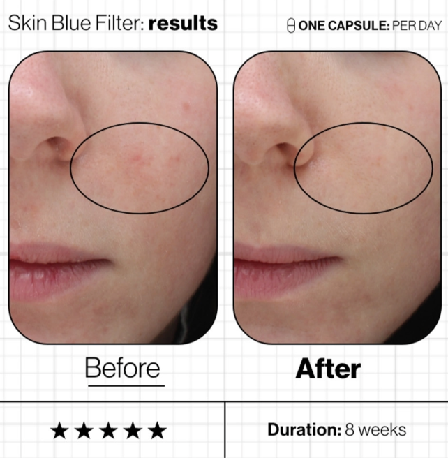 Advanced Nutrition programme Skin Blue Filter