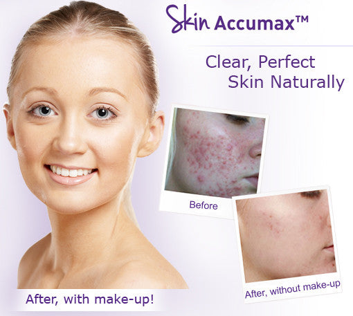 Skin Accumax Supersize 180 Capsules
