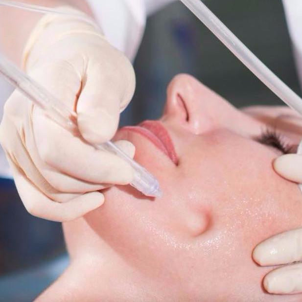 JetPeel Luxury Vitamin Infusion Facial 50-Mins with LED Light Therapy course of 4 (save €301)