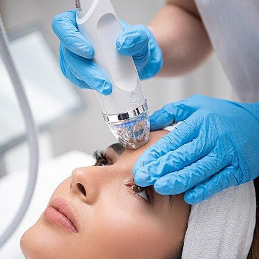 Cutera Secret RF +Microneedling with complimentary choice of skin booster (save €351)