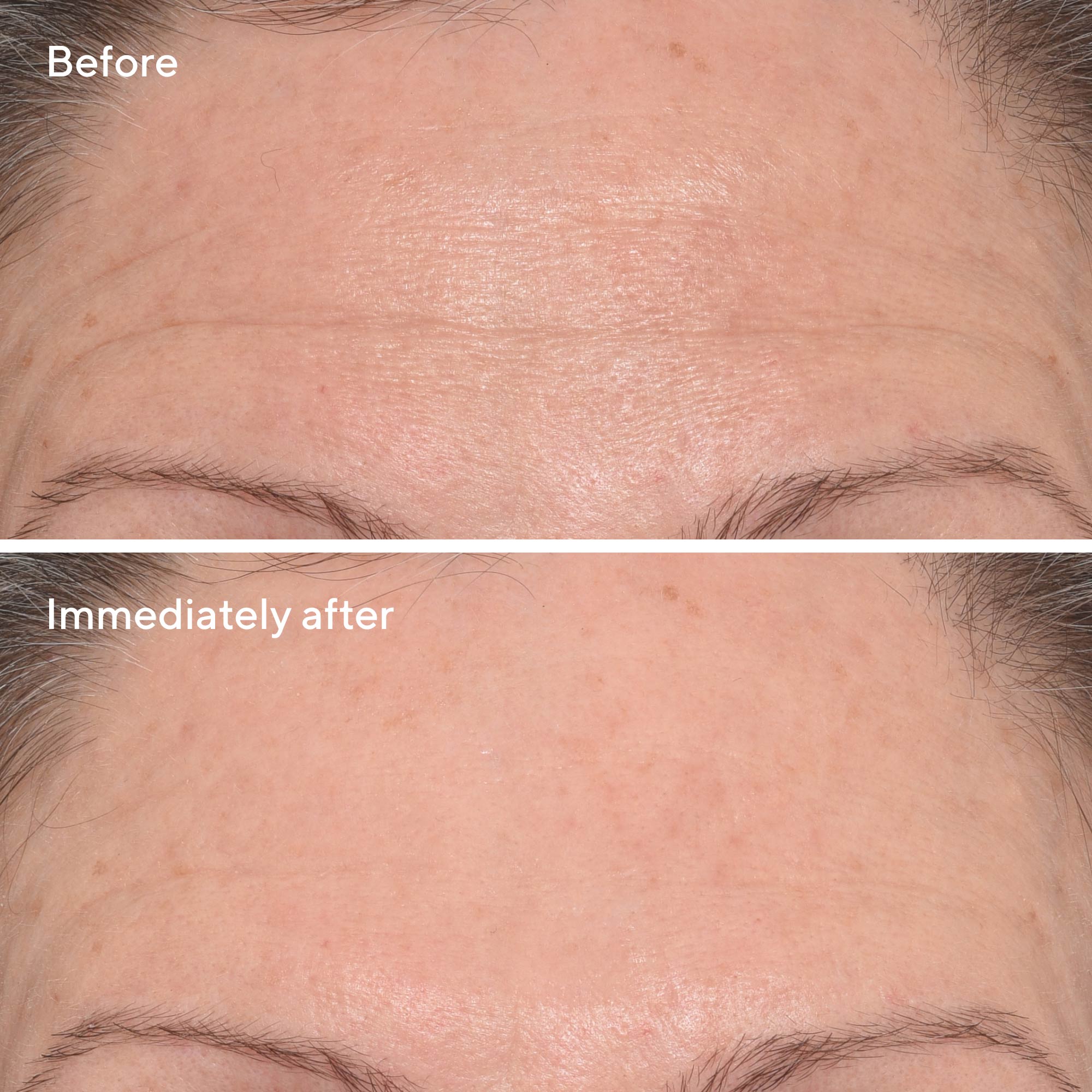 Murad Targeted Wrinkle Corrector 15ml