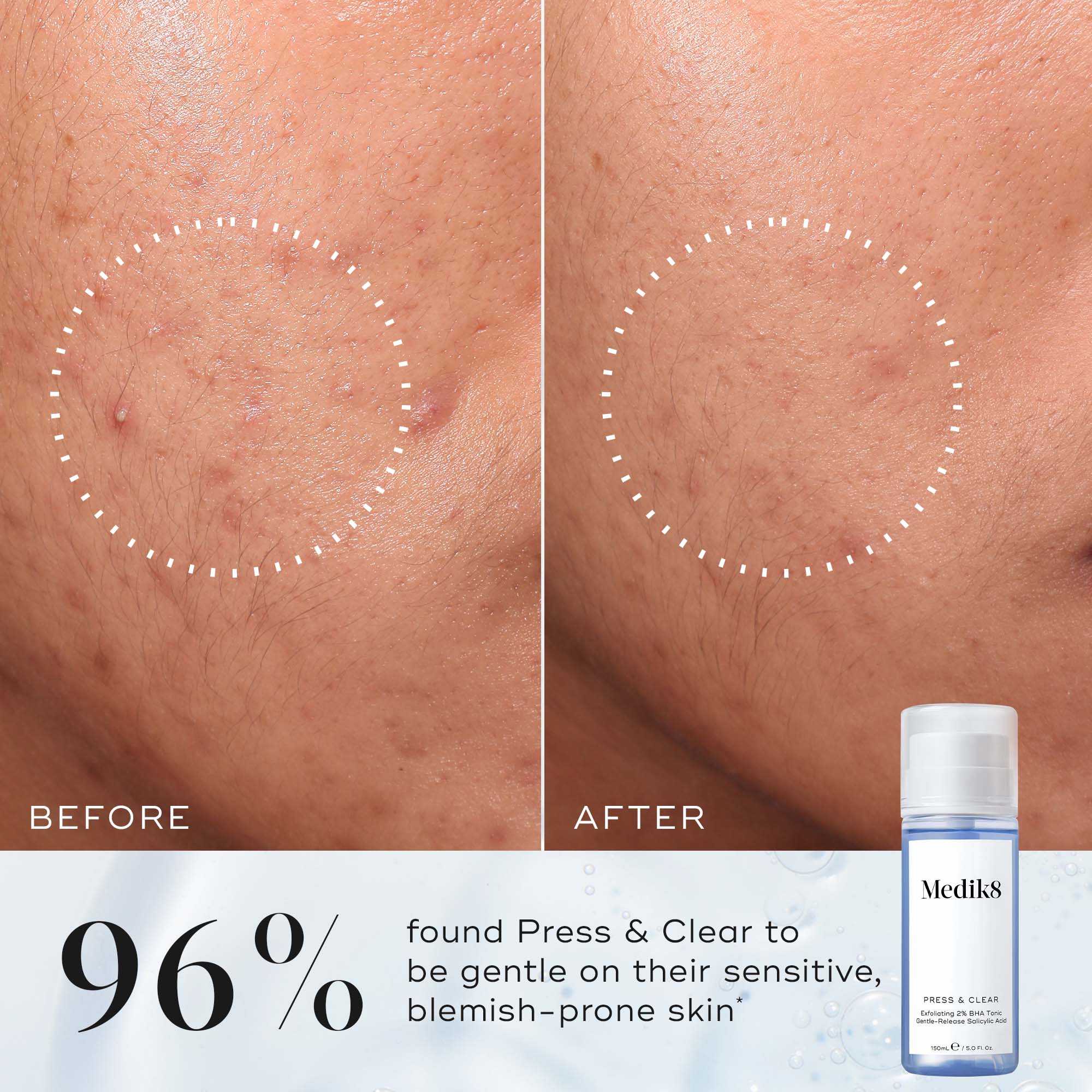 Medik8 PRESS & CLEAR 150 ml