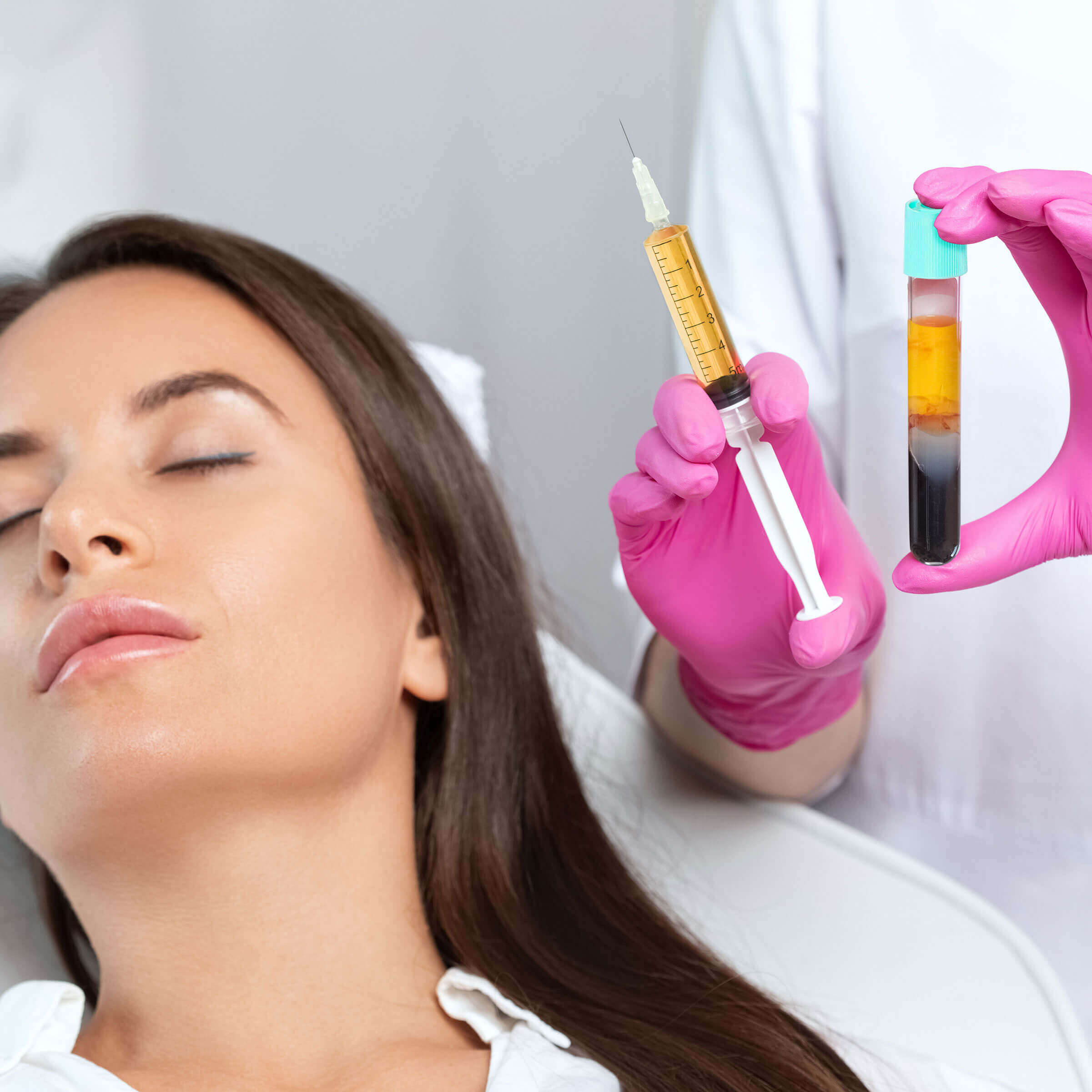 PRP (Platelet-Rich Plasma) for Face or Scalp (save €151)