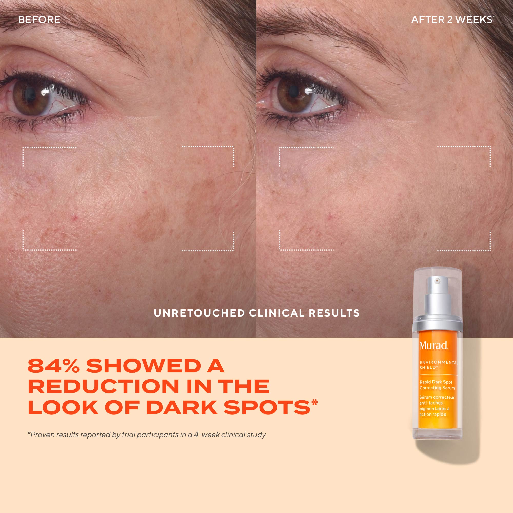Murad Rapid Dark Spot Correcting Serum 30ml