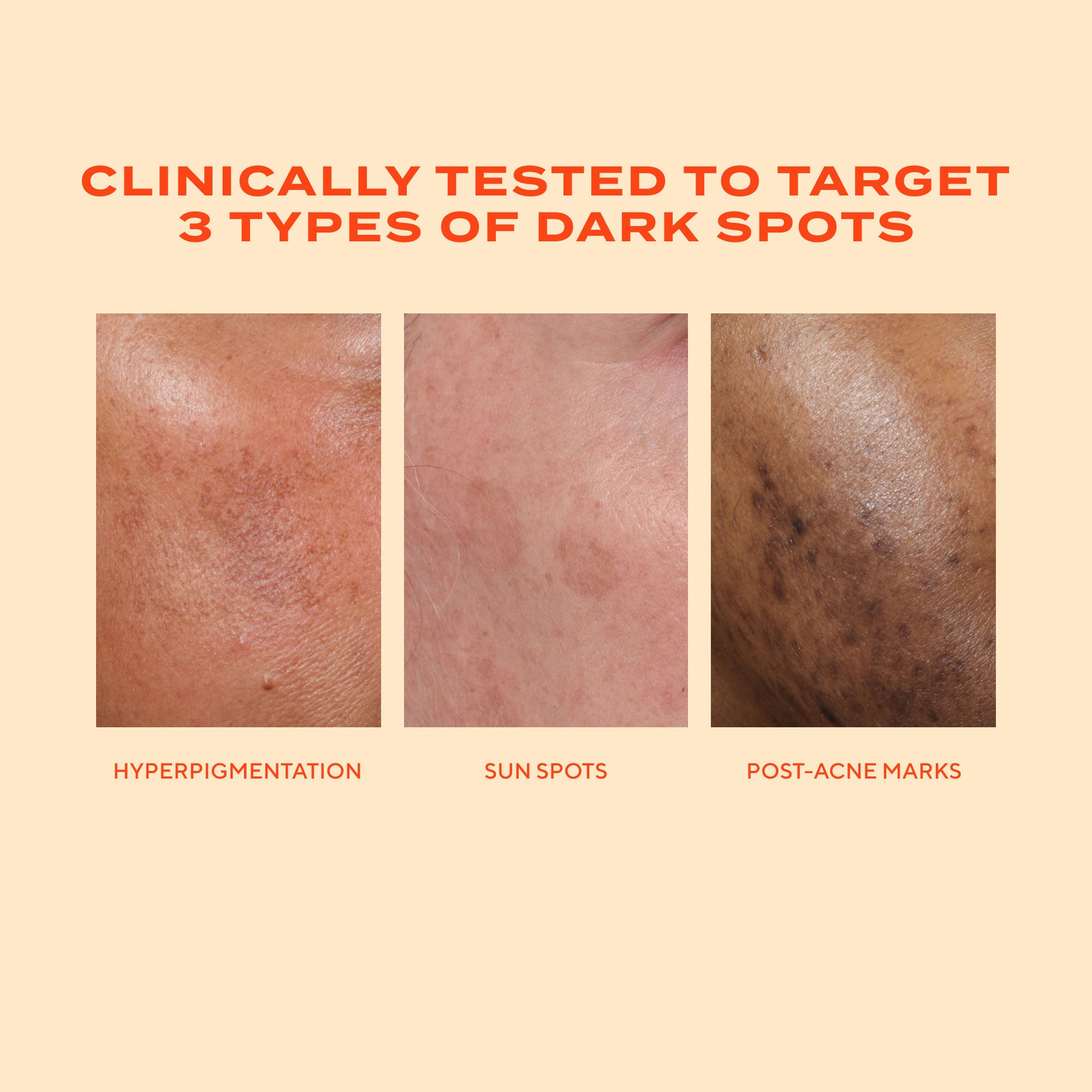 Murad Rapid Dark Spot Correcting Serum 30ml