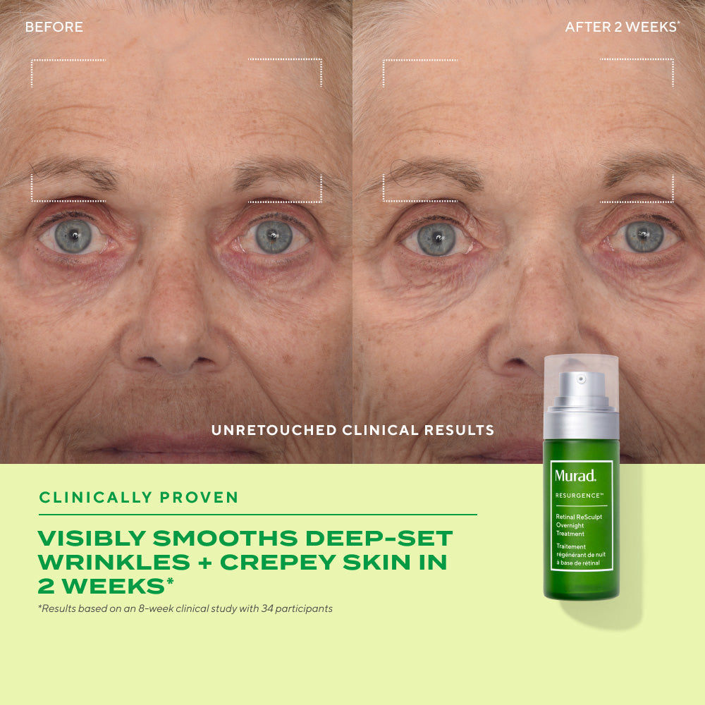 Murad Retinal ReSculpt Overnight Treatment 30ml