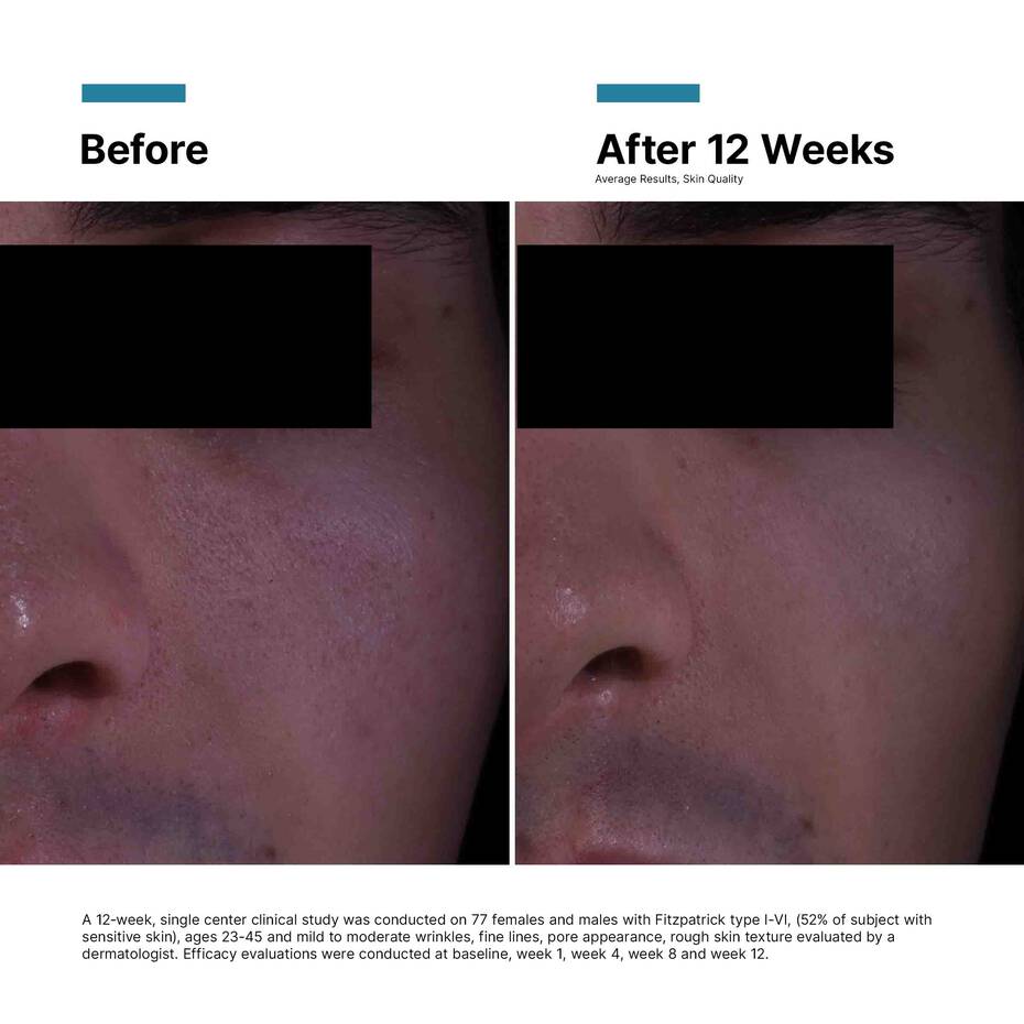 SkinCeuticals P-TIOX Anti-Wrinkle Cream 48ml
