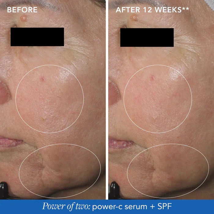 Image MD Restoring Power-C Serum