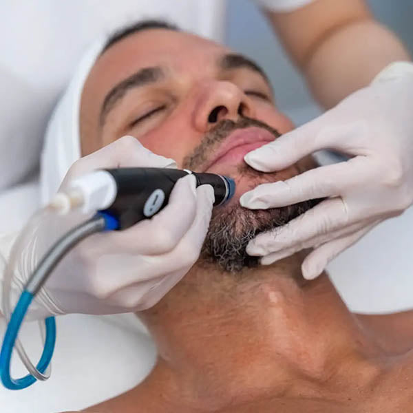 Black Friday: HydraFacial from only €99! (save up to €303)