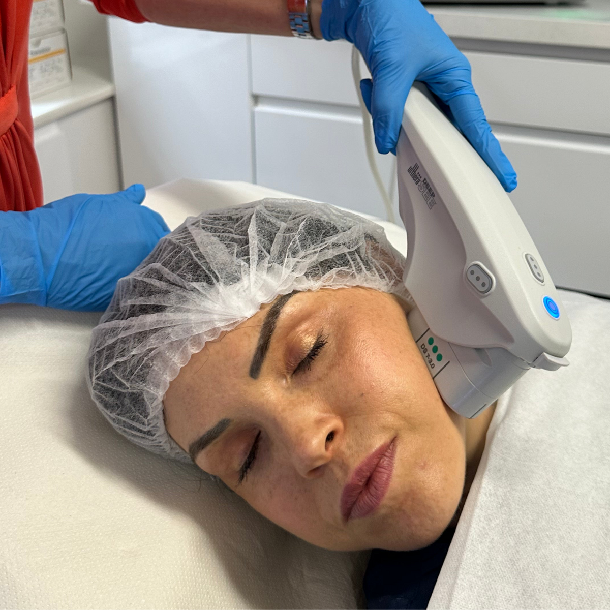 The Ultimate Lift & Resurface Collagen Duo: Ultherapy & CO2 Laser (save €1,751)