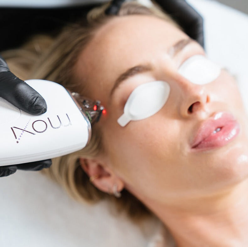 MOXI Laser Skin Rejuvenation course of 2 (save up to €501)