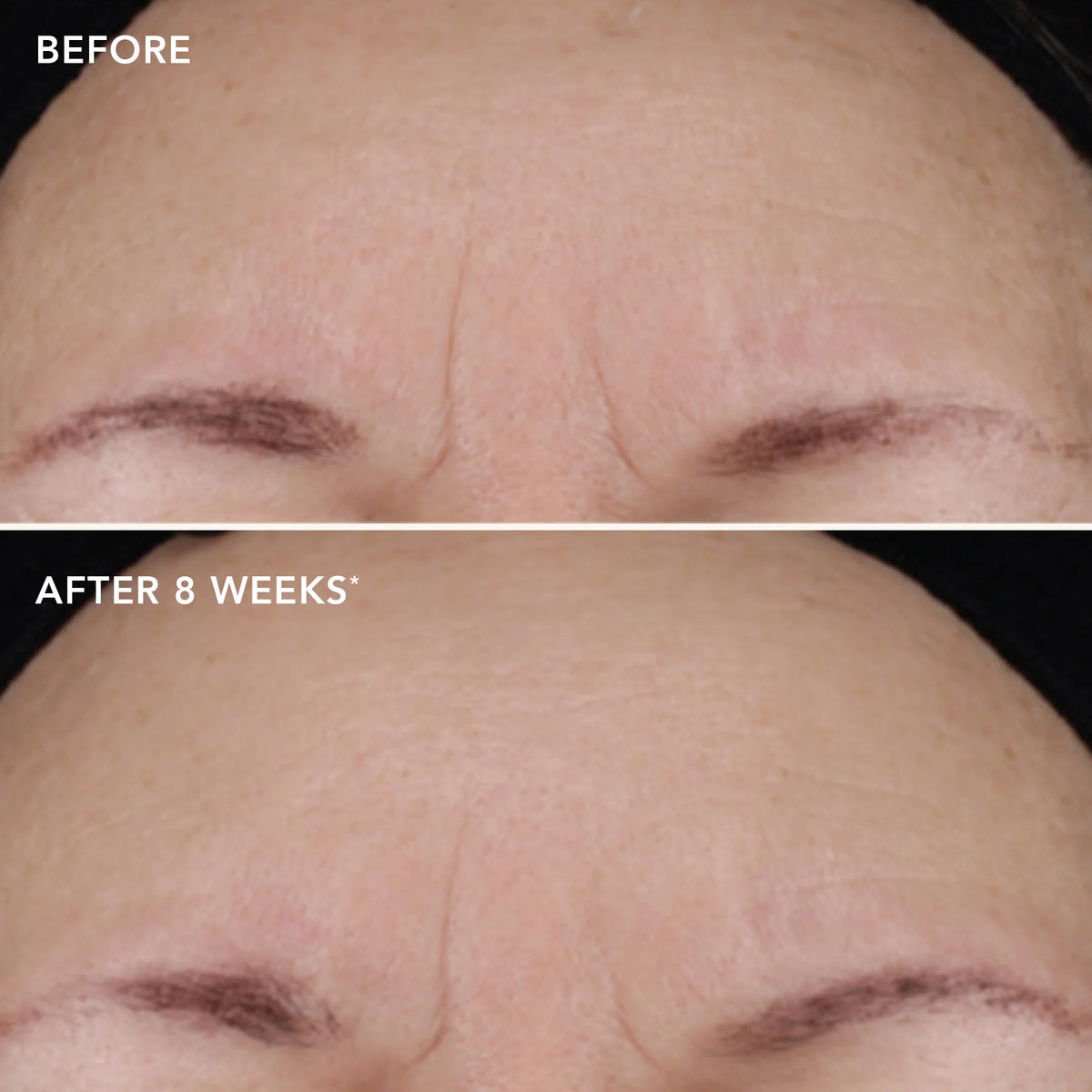 Image Skincare AGELESS+ Treatment Crème 1.2% Retinol Complex 28.5g