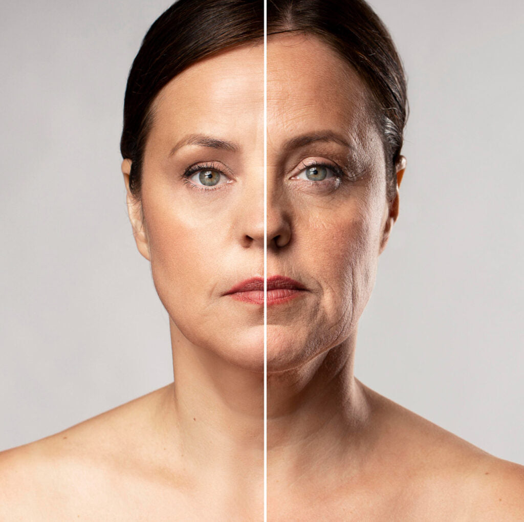 Profhilo for Face or Neck (save €101)