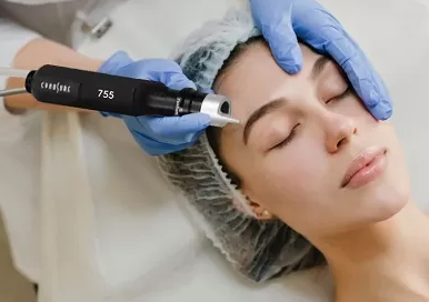 Picosure Laser Skin Rejuvenation Single Session