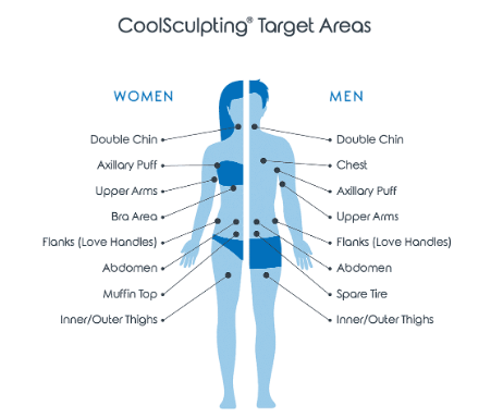 CoolSculpting Elite Chin Fat Package with RF Microneedling (save €1,151)
