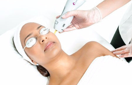 Laser Hair Removal for any small area course of 4 (save €51)