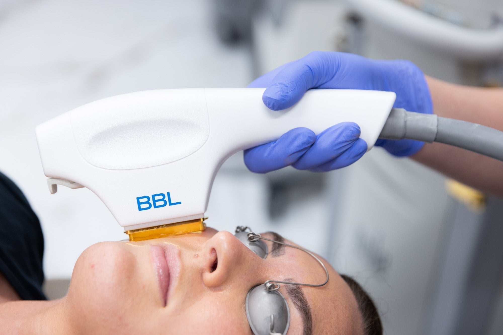 BBL HERO Laser Skin Rejuvenation Course of 2 (Save €301)