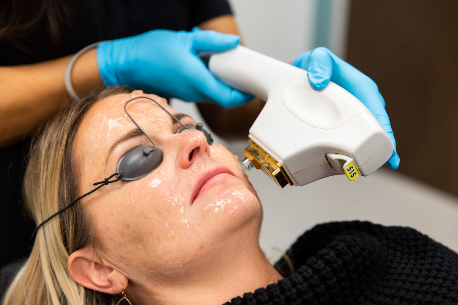 BBL HERO Laser Skin Rejuvenation Course of 2 (Save €301)