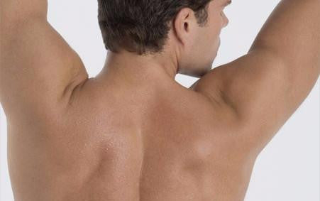 Laser Hair Removal for Men Full Back & Shoulders course of 4 (save €177)