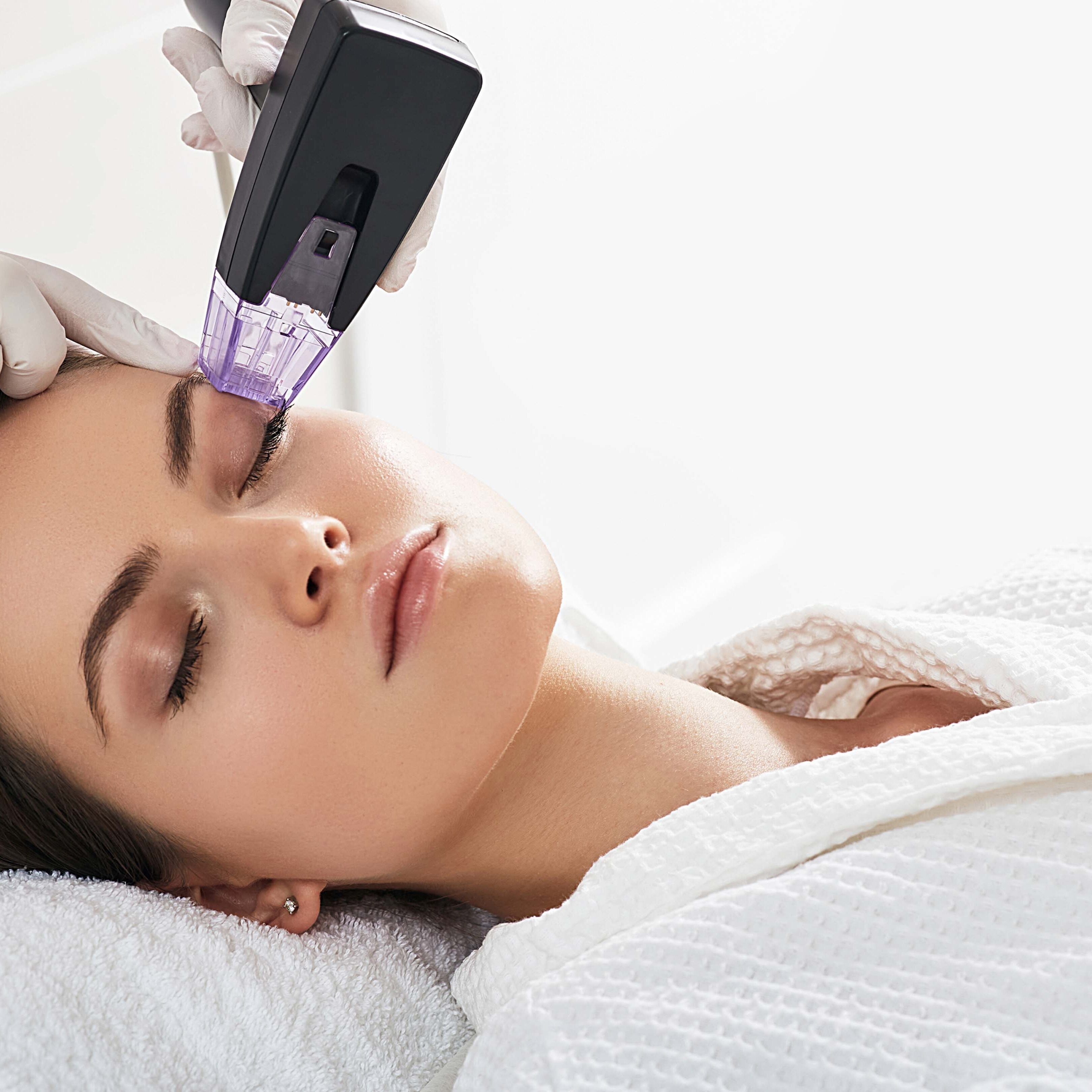 NEW Morpheus8 Burst RF Microneedling with optional Exosomes (save up to €1,551)