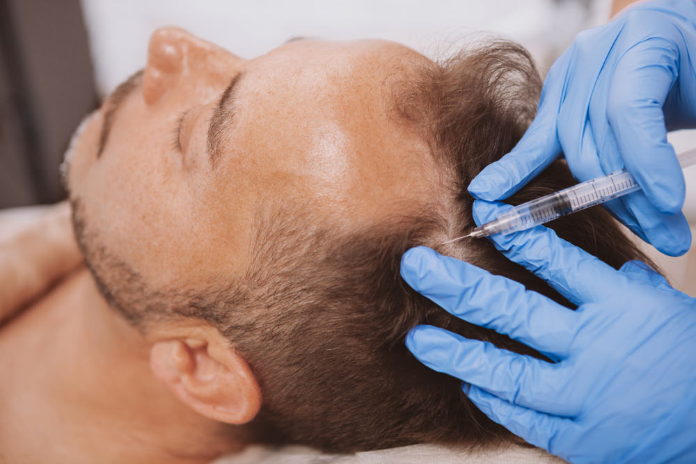 Complete Scalp Health Package: PRP + HydraFacial Keravive PRP + Exosomes + LED course of 3 (save €891)