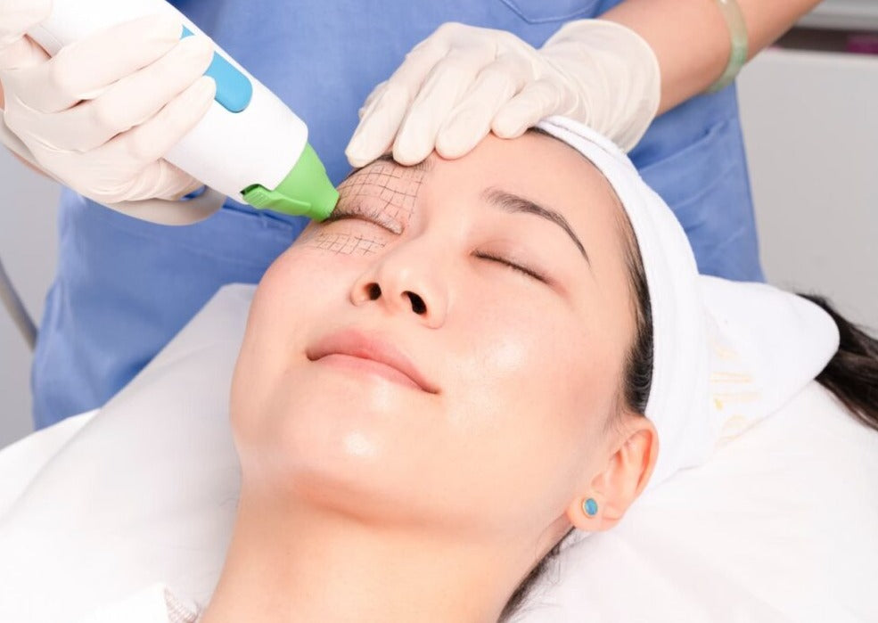 Under Eye Skin Booster + Thermage FLX Skin Tightening for Eyes (save €500)