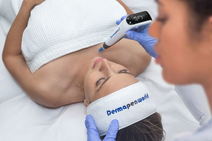 Dermapen Microneedling Skin Rejuvenation Full Face & Neck